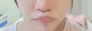 리더스코스메틱 리더스 카밍 바이오틱스 퀵 수딩 패드 — 5점을 준 리뷰어가 2022년 4월 올린 사용 사진
