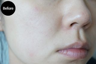 체르엠  프루브 콜라겐 앰플세럼 60ml 1병 — 5점을 준 리뷰어가 2021년 9월 올린 사용 사진