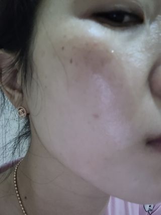 아이앤립 / EYENLIP 아이앤립 연어오일 리바이탈라이징 토너+앰플+크림 3종 세트 — 5점을 준 리뷰어가 2021년 6월 올린 사용 사진