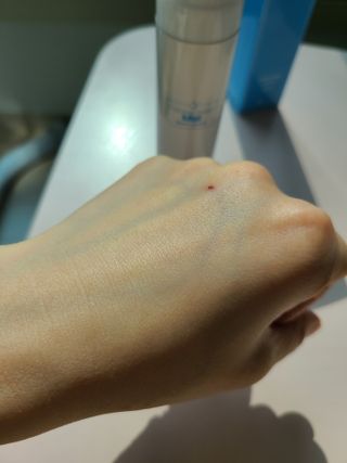 셀바이져 지우개 미스트 피부 보호 입주변 트러블 진정 케어 아기 안개분사 미스트 — 5점을 준 리뷰어가 2021년 3월 올린 사용 사진