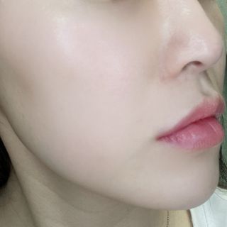 MF[스킨1004] 마다가스카르 센텔라 앰플 100ml — 5점을 준 리뷰어가 2024년 5월 올린 사용 사진