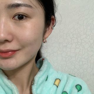 플리프 시카 알로에 스팟키트 — 4점을 준 리뷰어가 2021년 2월 올린 사용 사진