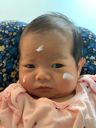 젠바이오 코스메틱스 젠바이오수딩크림]   가려운 피부 & 아토피 원픽 크림 — 4.5점을 준 리뷰어가 2022년 8월 올린 사용 사진