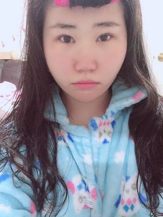 아이디플라코스메틱 아이디 페이스핏 마이너스 밴드 v2 — 2.5점을 준 리뷰어가 2020년 12월 올린 사용 사진
