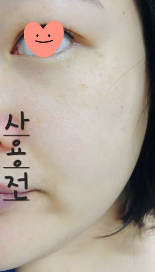 더메디코템 일루미네이팅 오로라 에멀젼마스크 — 5점을 준 리뷰어가 2025년 6월 올린 사용 사진
