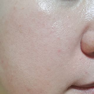 끌레비앙 펩타이드 볼륨 에센스 100ml — 5점을 준 리뷰어가 2021년 5월 올린 사용 사진