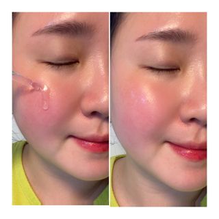 루트리 오디베리 5중 모공 리파이닝 앰플 — 5점을 준 리뷰어가 2023년 6월 올린 사용 사진