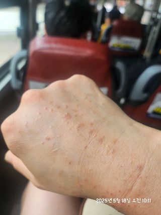 나우_ [리브엠] 화해 Best pick! 진정천재! 시카좀 카밍 워터 젤 크림 — 5점을 준 리뷰어가 2025년 5월 올린 사용 사진