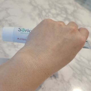 건선/아토/습진/민감성 피부 천연보습진정크림 소리온 크림 & 센시티브 크림 50g — 5점을 준 리뷰어가 2022년 1월 올린 사용 사진
