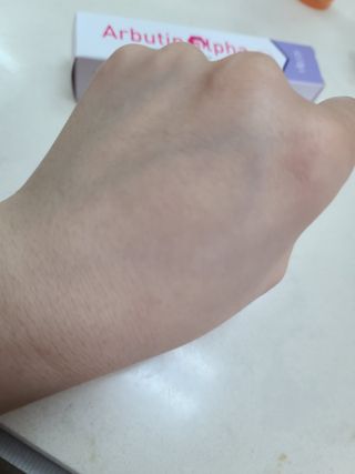 이엔코스 알부틴 알파 화이트닝크림 — 4점을 준 리뷰어가 2021년 3월 올린 사용 사진
