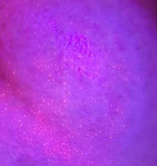 메데스 비츠케어 모공케어 피부관리키트 — 5점을 준 리뷰어가 2021년 6월 올린 사용 사진