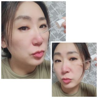 나나스킨 콤플렉스씨쓰리닥터클리어앰플 — 5점을 준 리뷰어가 2021년 9월 올린 사용 사진
