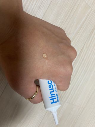 히루스카 포스트아크네 클리어 — 5점을 준 리뷰어가 2021년 1월 올린 사용 사진