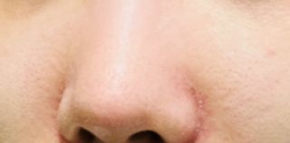 세뚜아(Cettua) 세뚜아 스티키 포어 패치 Cettua Sticky Pore Patch — 5점을 준 리뷰어가 2023년 11월 올린 사용 사진