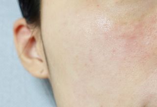 랑벨 비타 에너지 잡티 앰플 50ml 고농축 비타민, 저자극, 수분 촉촉, 미백 앰플 — 5점을 준 리뷰어가 2022년 3월 올린 사용 사진