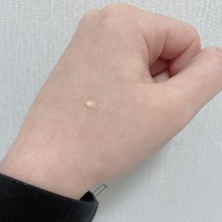 히루스카 포스트아크네 클리어 — 5점을 준 리뷰어가 2021년 2월 올린 사용 사진