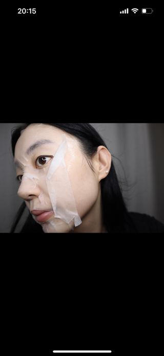 세뚜아(Cettua) 세뚜아 스팟 클리어 듀얼 패치 Cettua Spot Clear Dual Patch — 4.5점을 준 리뷰어가 2023년 7월 올린 사용 사진