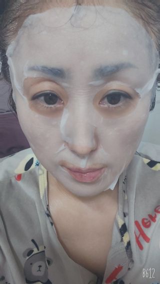 쿠피 피디알엔 연어 더마 페이셜 마스크 — 5점을 준 리뷰어가 2022년 1월 올린 사용 사진