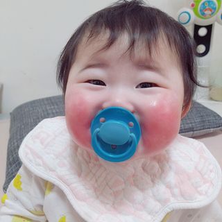건선/아토/습진/민감성 피부 천연보습진정크림 소리온 크림 & 센시티브 크림 50g — 5점을 준 리뷰어가 2022년 2월 올린 사용 사진