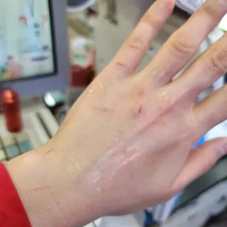 랑벨 랑바이오 블랙 시카 퀵 패드 100매 (3초 쿨링/3분 흡수, 블랙비 프로폴리스/시카 4종 함유, 대용량) — 5점을 준 리뷰어가 2022년 5월 올린 사용 사진