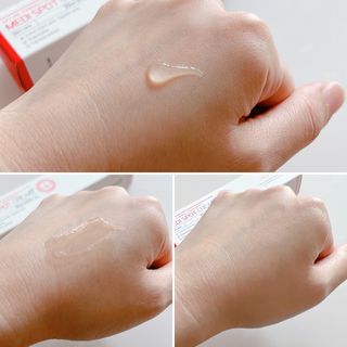 작심연구소 바르는 피부과 레이저 메디스팟크림 플러스 — 5점을 준 리뷰어가 2022년 6월 올린 사용 사진