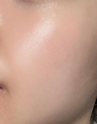 MF[더메디코템] 스피큘 DCA V리프팅 크림 — 4점을 준 리뷰어가 2024년 4월 올린 사용 사진