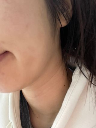 리더스코스메틱 리더스 퍼스트 샷 액티브 에센스 에이지 컨트롤 — 5점을 준 리뷰어가 2021년 11월 올린 사용 사진