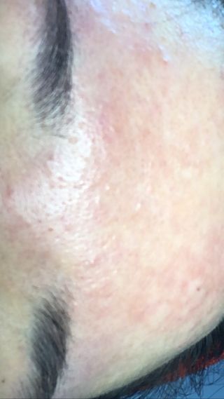 체르엠 스템앤셀 비타민 브라이트닝 에센스 30ml 1개 — 4점을 준 리뷰어가 2021년 12월 올린 사용 사진