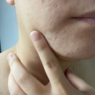 [큐어반H 커팅] 간편하게 떼서 쓰는 자외선차단 습윤밴드 (1팩/30매입) — 5점을 준 리뷰어가 2022년 12월 올린 사용 사진