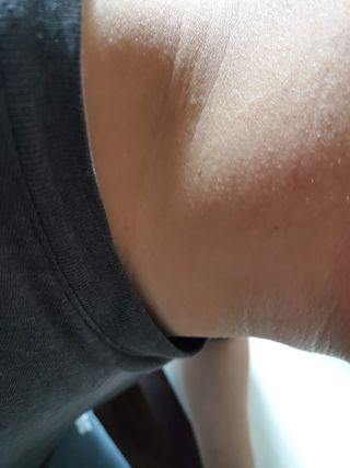 건선/아토/습진/민감성 피부 천연보습진정크림 소리온 크림 & 센시티브 크림 50g — 5점을 준 리뷰어가 2022년 2월 올린 사용 사진