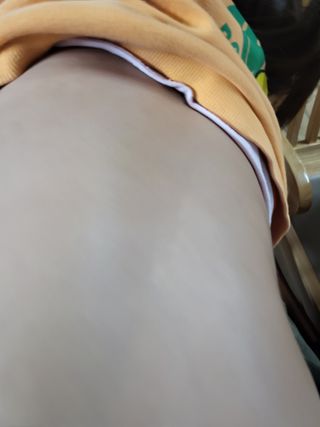 건선/아토/습진/민감성 피부 천연보습진정크림 소리온 크림 & 센시티브 크림 50g — 5점을 준 리뷰어가 2022년 1월 올린 사용 사진