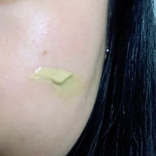 건선/아토/습진/민감성 피부 천연보습진정크림 소리온 크림 & 센시티브 크림 50g — 5점을 준 리뷰어가 2022년 1월 올린 사용 사진