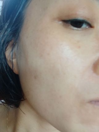 프리 (인스타체험단) [밀리밀리] 메디 앰플 비타 15ml — 4점을 준 리뷰어가 2025년 8월 올린 사용 사진