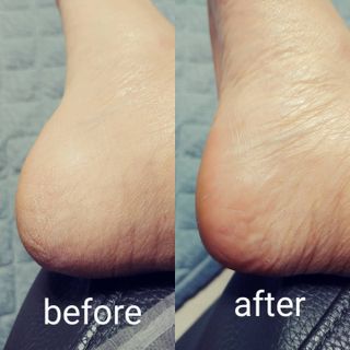 성분에디터 시어버터 아기발스틱 — 5점을 준 리뷰어가 2021년 6월 올린 사용 사진