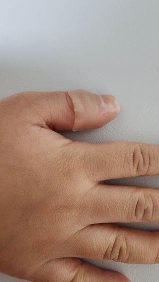 [큐어반H 커팅] 간편하게 떼서 쓰는 자외선차단 습윤밴드 (1팩/30매입) — 5점을 준 리뷰어가 2022년 12월 올린 사용 사진