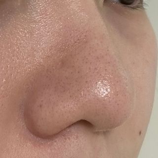 세뚜아(Cettua) 세뚜아 스티키 포어 패치 Cettua Sticky Pore Patch — 5점을 준 리뷰어가 2023년 9월 올린 사용 사진