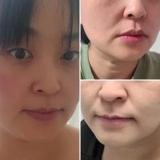 웰피아생활건강 웰피아 롤리올리 — 5점을 준 리뷰어가 2023년 1월 올린 사용 사진