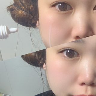 리더스코스메틱 리더스 카밍 바이오틱스 에센스 워터 — 5점을 준 리뷰어가 2021년 3월 올린 사용 사진
