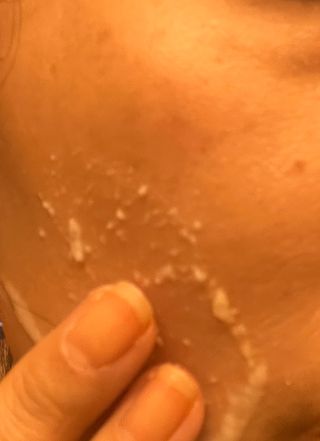 [후르디아] 아보카도 비건 약산성 효소필링젤 — 4점을 준 리뷰어가 2024년 1월 올린 사용 사진