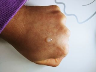 냉장고에 넣어요, 붉은 트러블 피부 다음날 진정되요 [버진팜스 푸딩수딩아토] — 5점을 준 리뷰어가 2021년 1월 올린 사용 사진