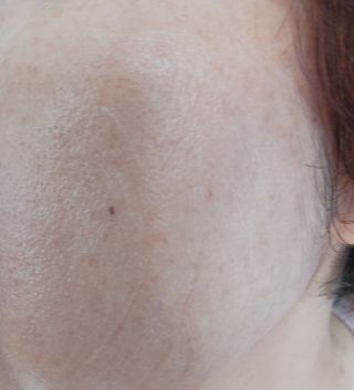 하이브리온 [구매평]닥터초이스 갈락토미 프로바이오틱 세범케어 올인원 로션 1개, 100ml — 5점을 준 리뷰어가 2025년 9월 올린 사용 사진