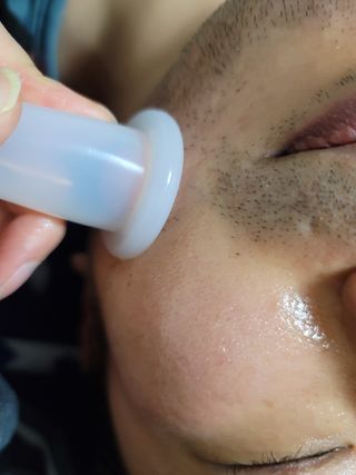 메디미케이알 커핑테라피 실리콘부항마사지 리프팅 페이스+바디 안티 셀룰 라이트 6pcs — 3점을 준 리뷰어가 2021년 2월 올린 사용 사진