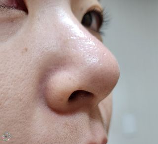 세뚜아(Cettua) 세뚜아 스티키 포어 패치 Cettua Sticky Pore Patch — 4점을 준 리뷰어가 2023년 9월 올린 사용 사진