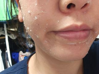 [후르디아] 아보카도 비건 약산성 효소필링젤 — 5점을 준 리뷰어가 2024년 4월 올린 사용 사진