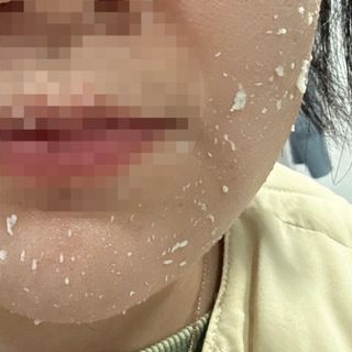 [후르디아] 아보카도 비건 약산성 효소필링젤 — 5점을 준 리뷰어가 2024년 1월 올린 사용 사진