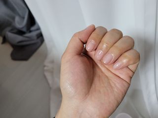바이오오일 [바이오-오일] 드라이 스킨 젤 100ml — 5점을 준 리뷰어가 2021년 12월 올린 사용 사진
