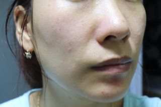 메디힐 워터마이드 포어 타이트닝 에센스 패드 — 5점을 준 리뷰어가 2021년 6월 올린 사용 사진