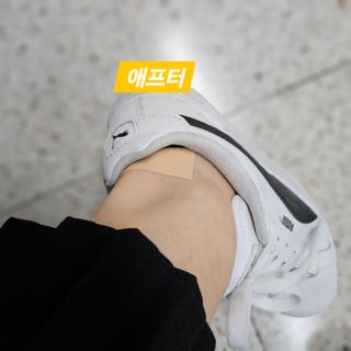 3M 넥스케어 물집방지쿠션테이프 1매 + 물집방지패드 10매 — 5점을 준 리뷰어가 2024년 4월 올린 사용 사진