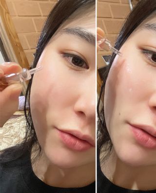 바베 BABE 바베 프로테오글리칸 F+F 앰플 솔루션 — 5점을 준 리뷰어가 2021년 1월 올린 사용 사진