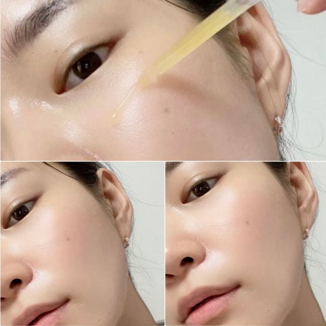 청담로즈 로즈블랑 화이트닝 슈퍼 리페어 리커버리 앰플 리뷰 사진